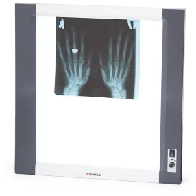 негатоскоп общего назначения 1-кадровый lux