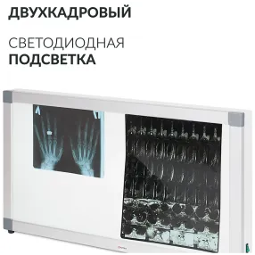 негатоскоп общего назначения 2-кадровый