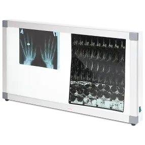 негатоскоп общего назначения 2-кадровый